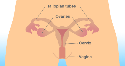 _41381353_ovarian_cancer.gif